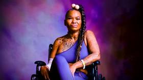 Apple Watts' Car Accident: What Happened to Love and Hip Hop Star