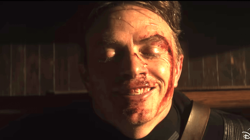 Wilson Bethel as Bullseye in Daredevil: Born Again Season 2.