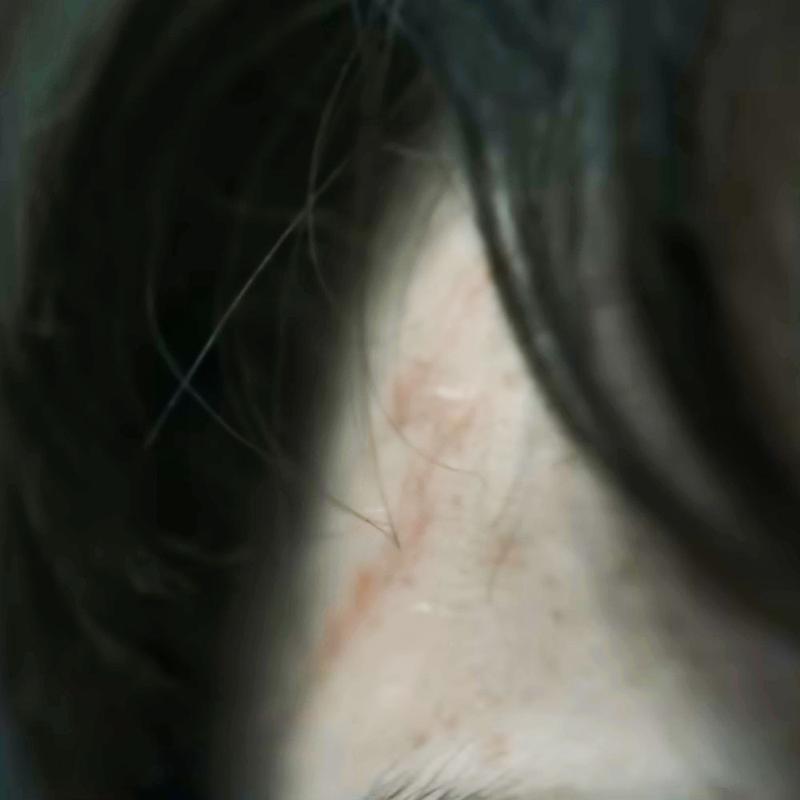 Harry Potter HBO, Dominic McLaughlin, lightning bolt scar.