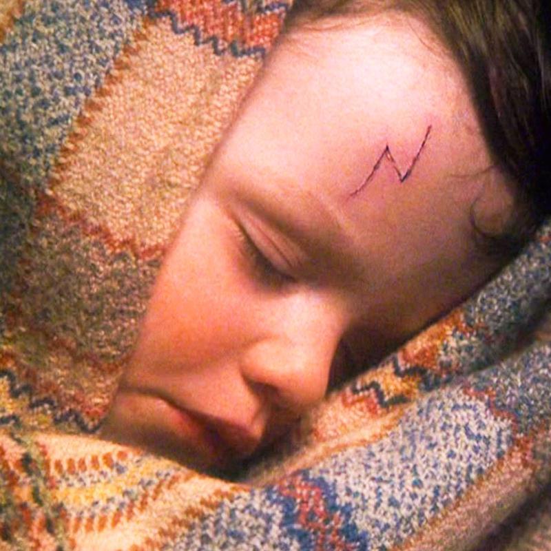 Harry Potter and the Philosopher's Stone, scar on forehead as a baby.