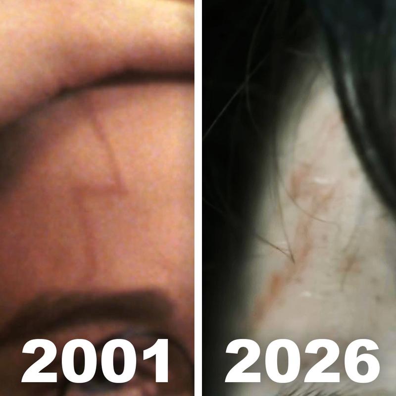 HBO Harry Potter scar in movies vs show.