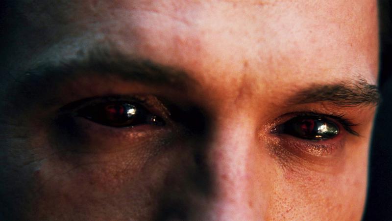 Peter Parker will black eyes.