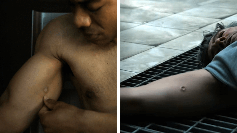 The two similar marks on Hal and John.
