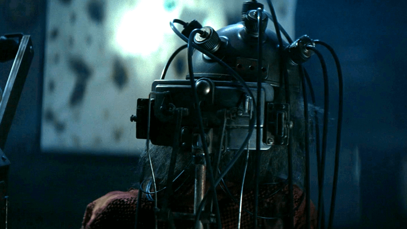 The back of the Brain Computing Interface on someone's head in Fallout Season 2